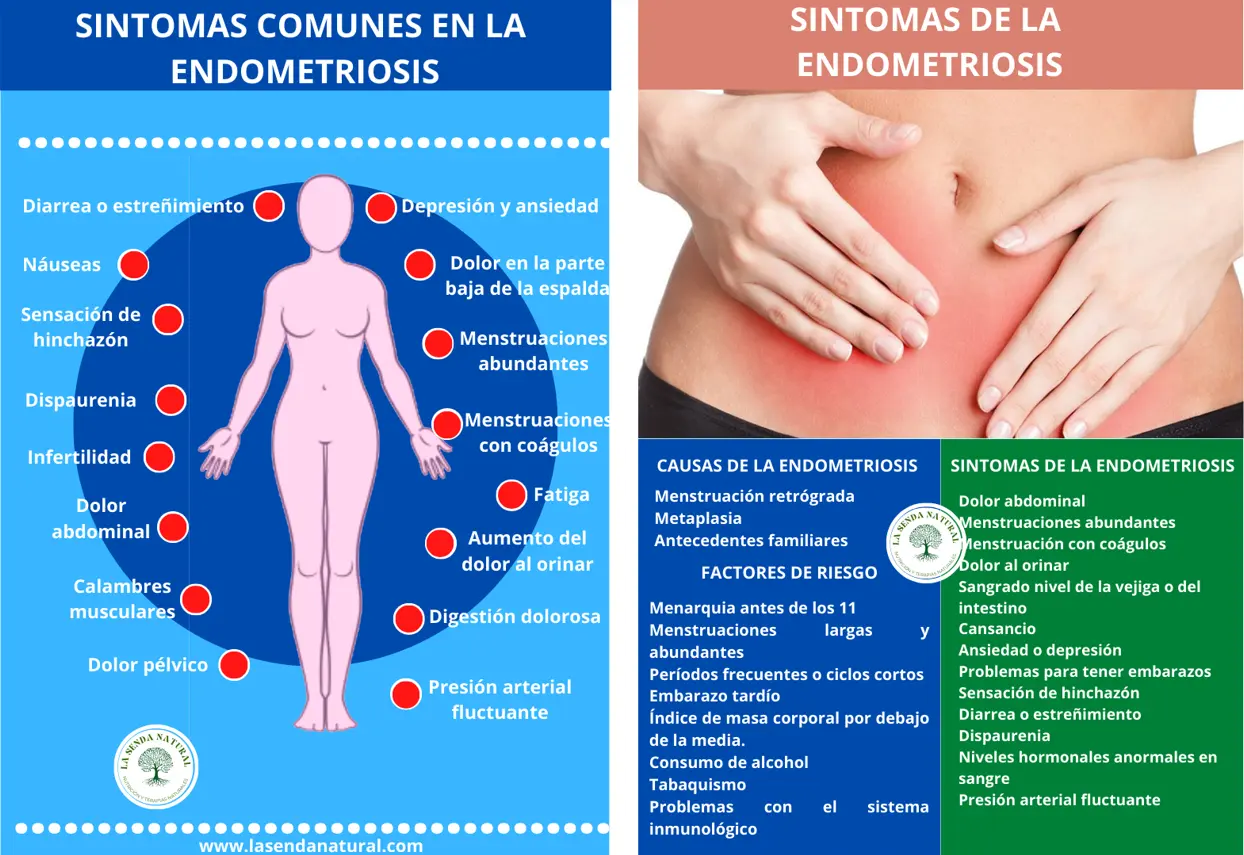 SINTOMAS DE LA ENDOMETRIOSIS