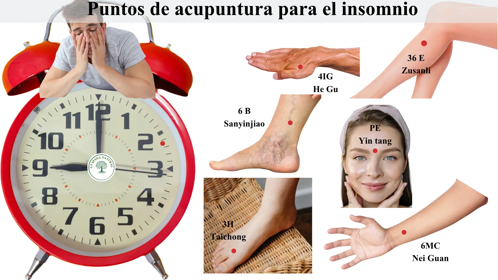 Puntos de acupuntura para el insomnio