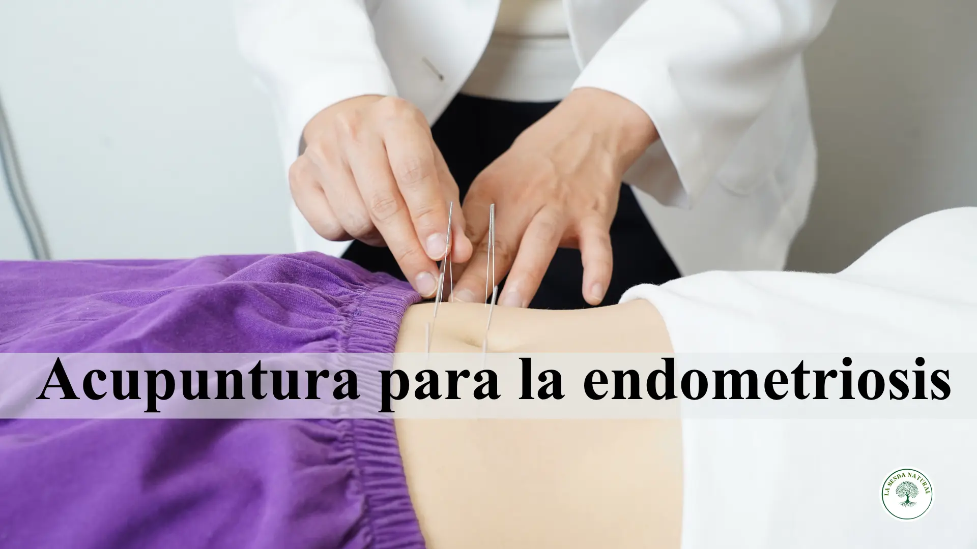 Acupuntura para la endometriosis