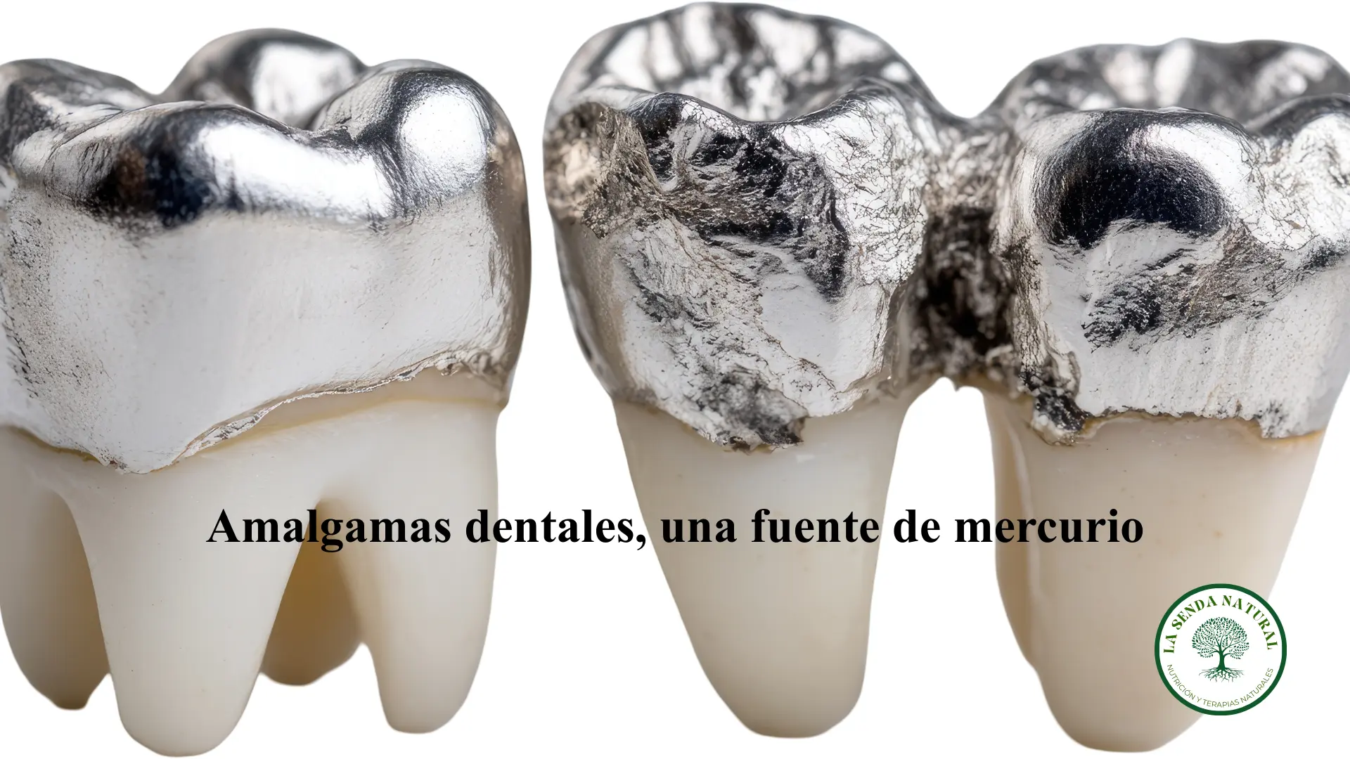 Amalgamas dentales