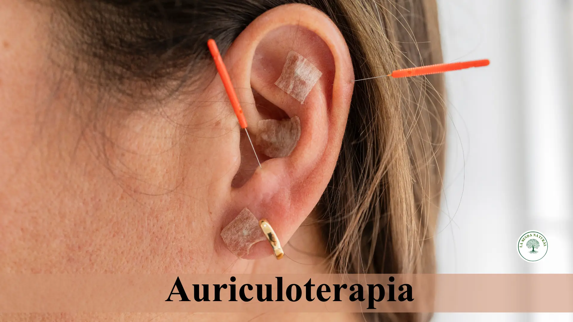 Auriculoterapia