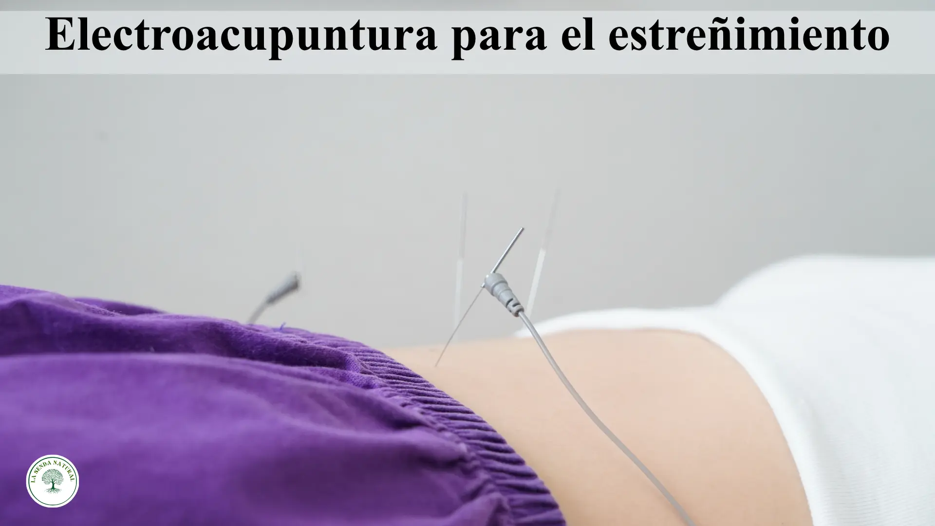 Electroacupuntura para el estreñimiento