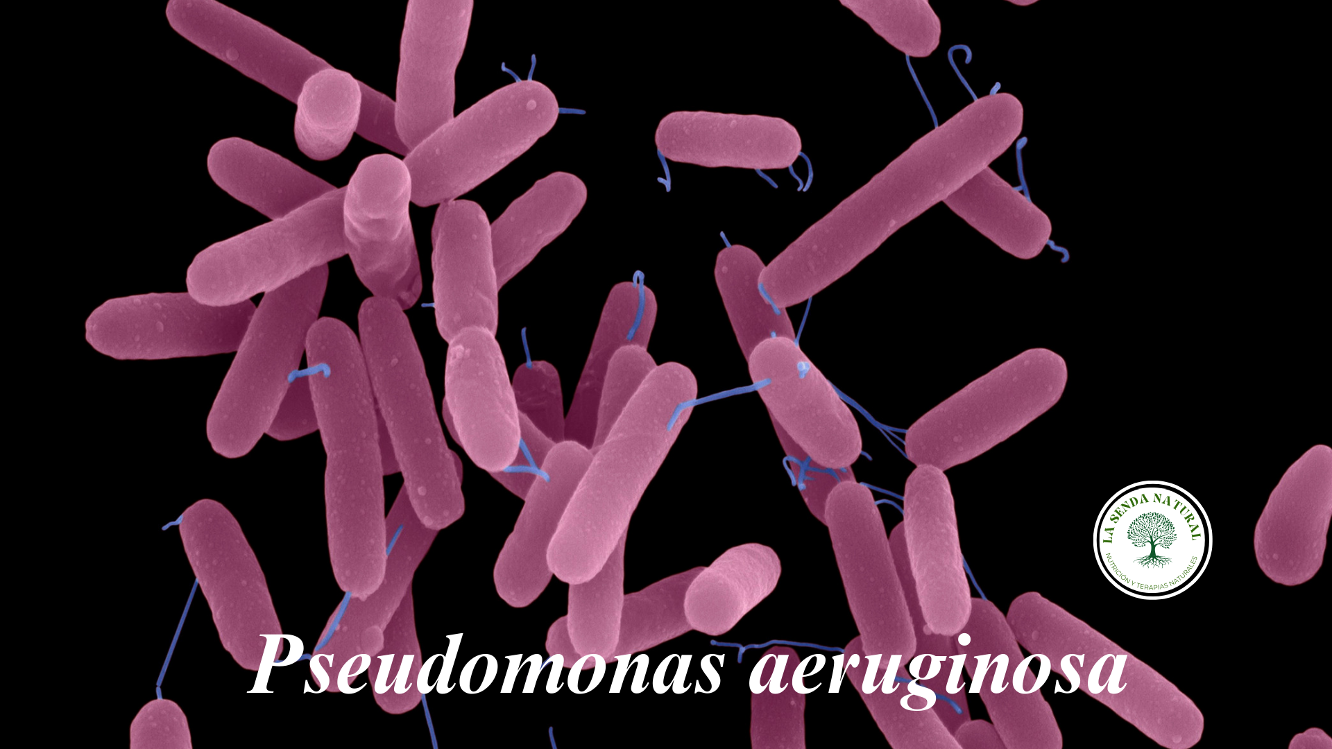 Que son las Pseudomonas aeruginosa