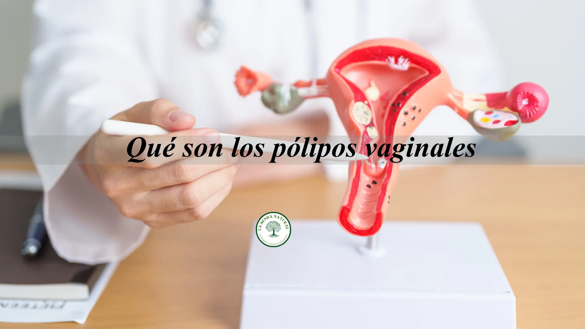 Pólipos endometriales