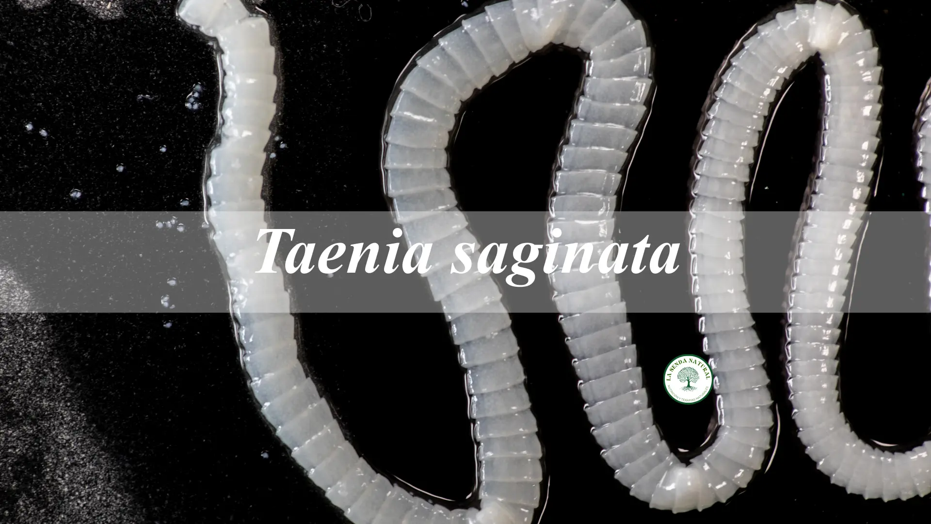 TAENIA SAGINATA