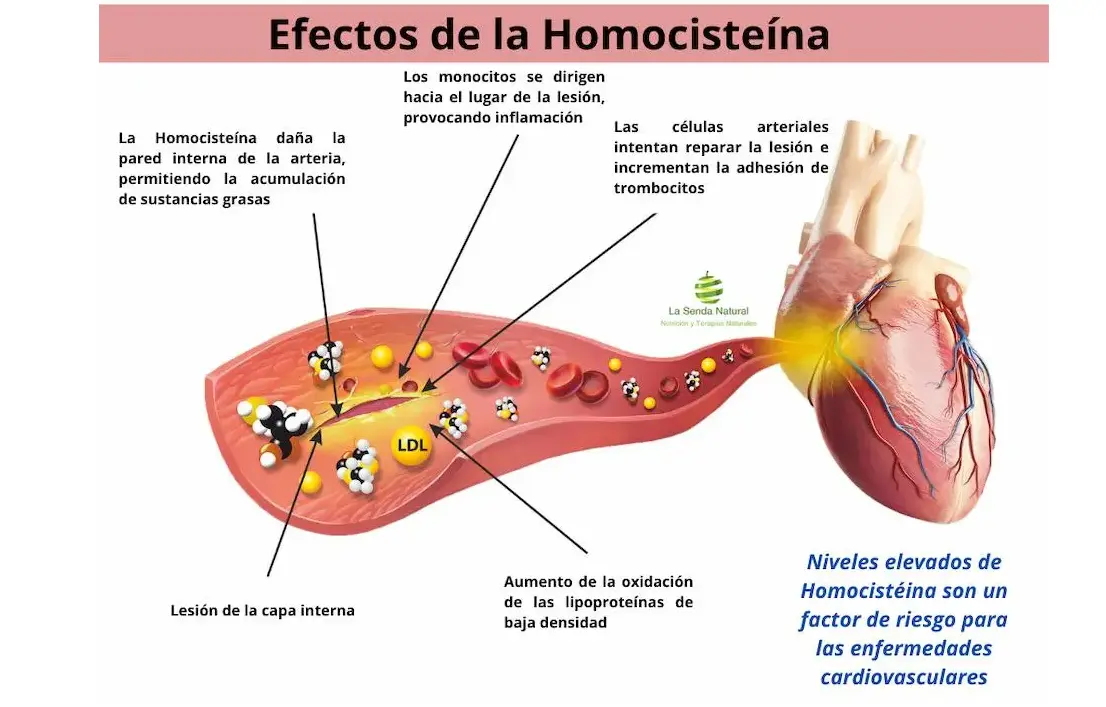 homocisteína y problemas cardiovasculares
